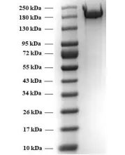 SDS-PAGE of Beta Variant Spike Protein