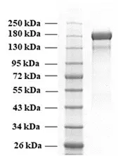 SDS-PAGE of Delta Variant Spike Protein