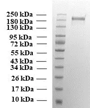 SDS-PAGE of Gamma Variant Spike Protein