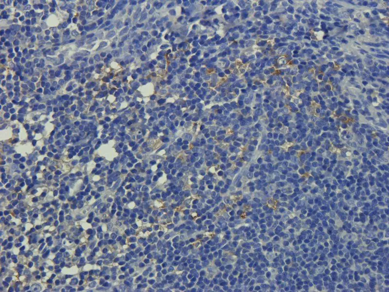 Collagen IV IHC Staining