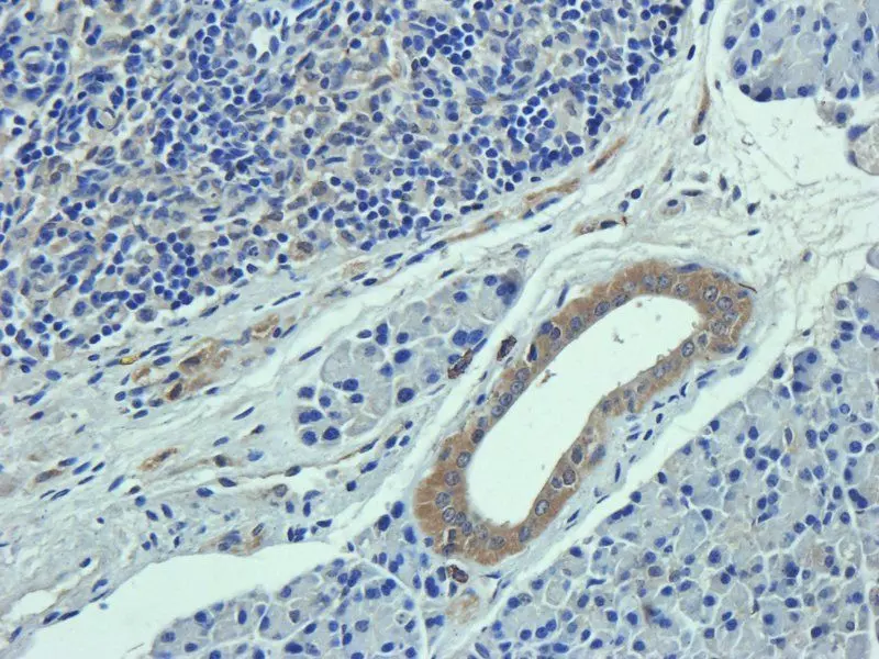 Collagen I IHC Staining