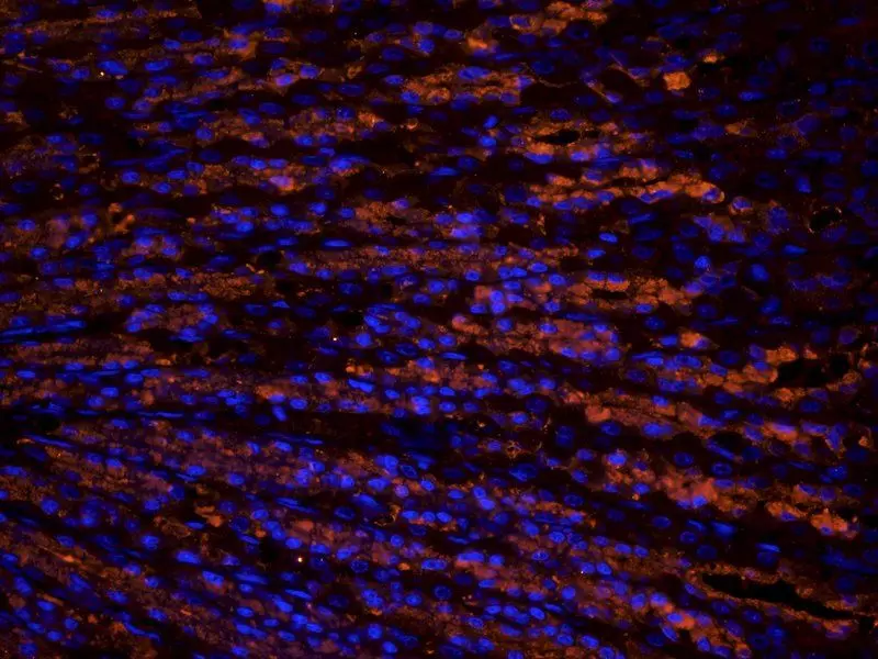 Collagen III IHC Staining