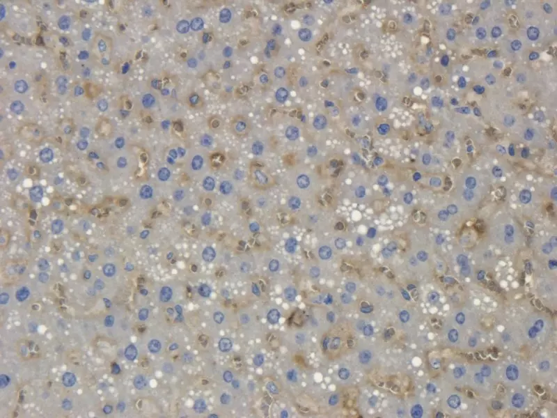 IHC-P staining of Collagen X in rat liver tissue