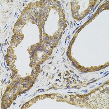 免疫组织化学（IHC）和免疫细胞化学 （ICC）在癌症研究中的应用2