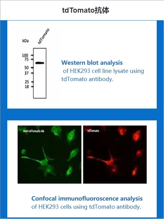 Biorbyt明星产品【tdTomato抗体】：再添2篇nature文献4