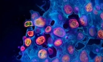 Molecular Biology