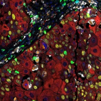 Activated T Cell PathPlex Panel