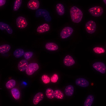 Rabbit anti-Ki-67 Antibody