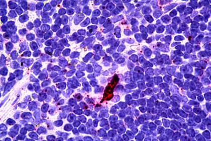 IHC staining of human lymphoid-dendritic cells using EBI3 antibody