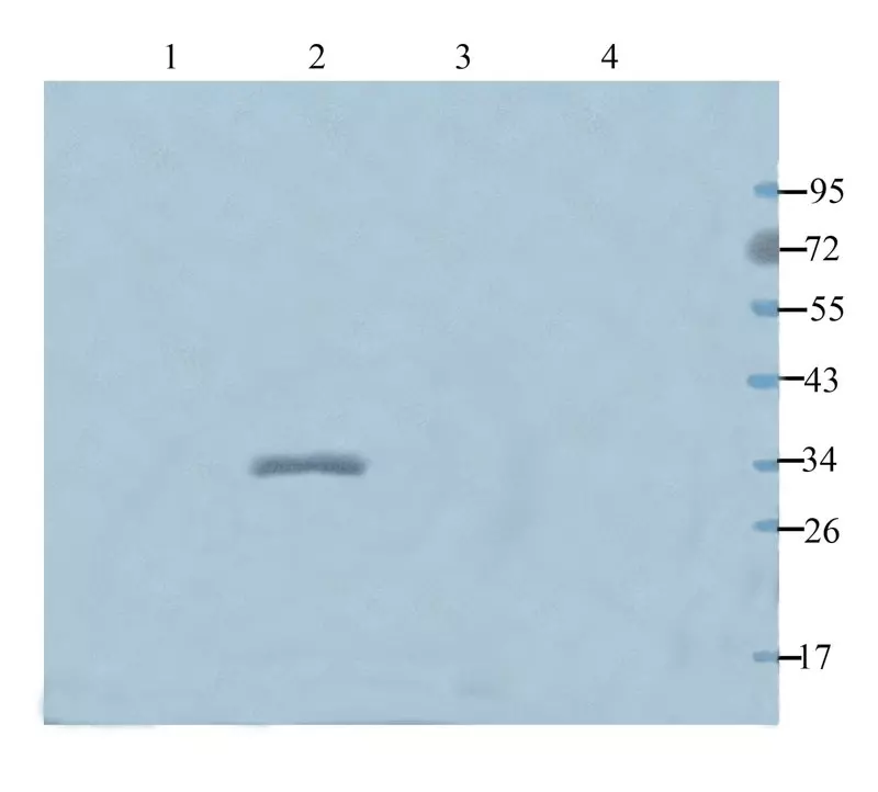 Western Blot analysis of Filaggrin across tissue lysates