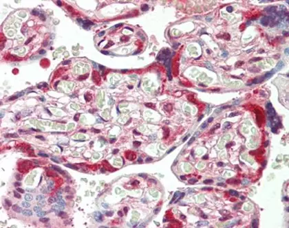 HSP90AB1 IHC Staining