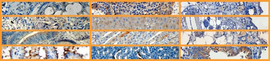 Immunohistochemistry Tips Banner Background