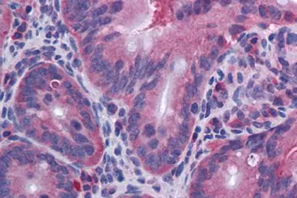 IHC staining of mouse small intestine using IL-10 antibody