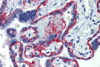IHC staining of human placenta tissue using Integrin Beta 4 antibody