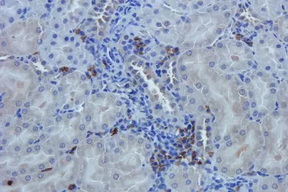 Immunohistochemical staining showing Nestin antibody