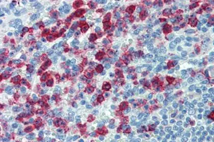 IHC staining of human spleen tissue using PSGL-1 antibody
