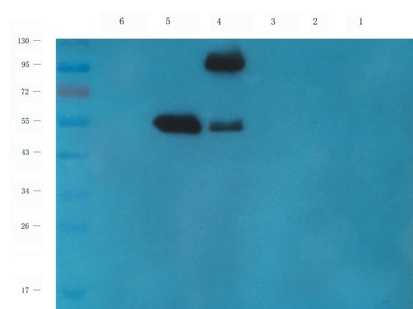 CD213a2 Rabbit Polyclonal Antibody