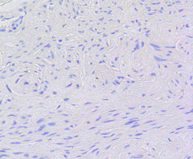 V-Myb/C-Myb(Phospho-Ser11) Rabbit mAb Antibody