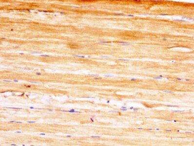 YWHAH Antibody