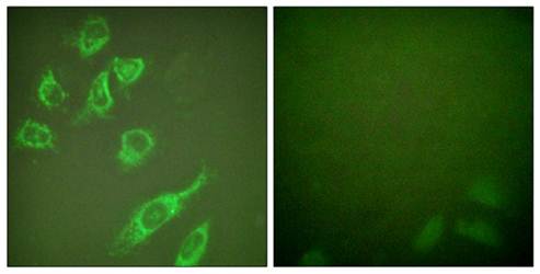 14-3-3 ζ (Phospho-Ser58) Antibody