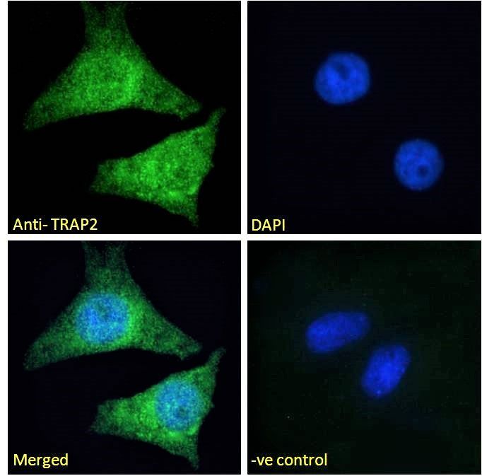 TRAP2/Proteasome subunit 26S Antibody