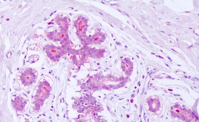 Syntenin/SDCBP Antibody