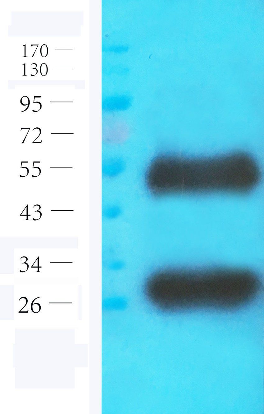 ICAM1 Mouse Monoclonal Antibody