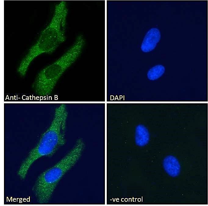 Cathepsin B Antibody