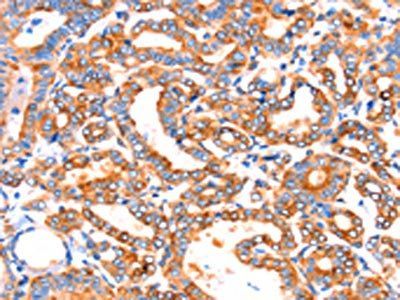 SEPT4 Antibody