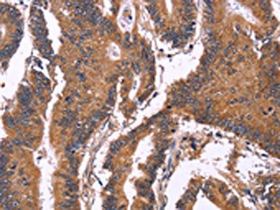 SEPT7 Antibody