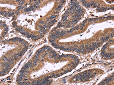 SEPT7 Antibody