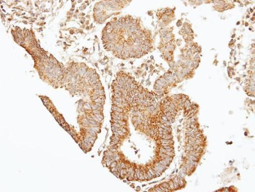 SEPT7 Rabbit Polyclonal Antibody