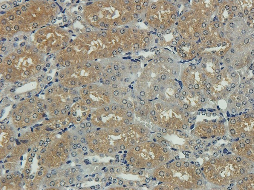 GGT1 Rabbit Polyclonal Antibody