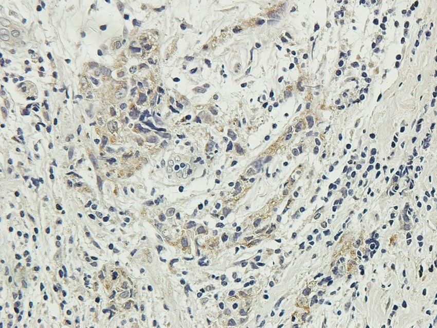 GGT1 Rabbit Polyclonal Antibody
