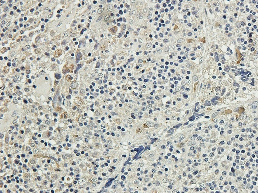GGT1 Rabbit Polyclonal Antibody