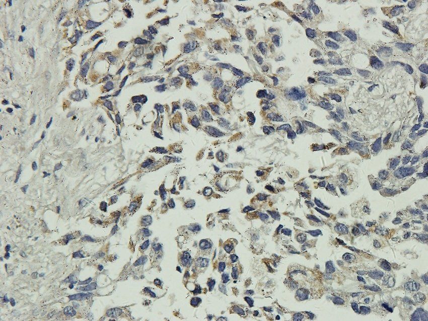 GGT1 Rabbit Polyclonal Antibody