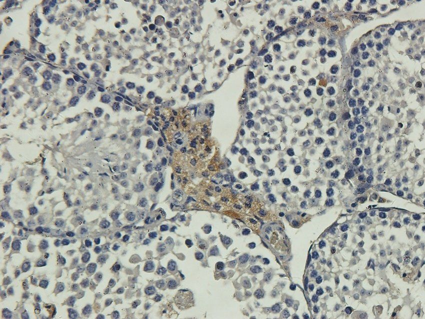 GGT1 Rabbit Polyclonal Antibody
