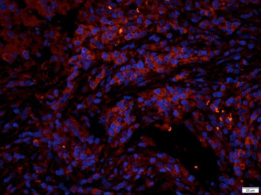 GGT1 Rabbit Polyclonal Antibody