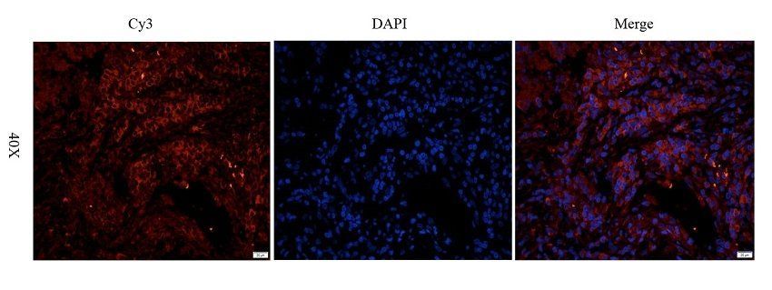 GGT1 Rabbit Polyclonal Antibody