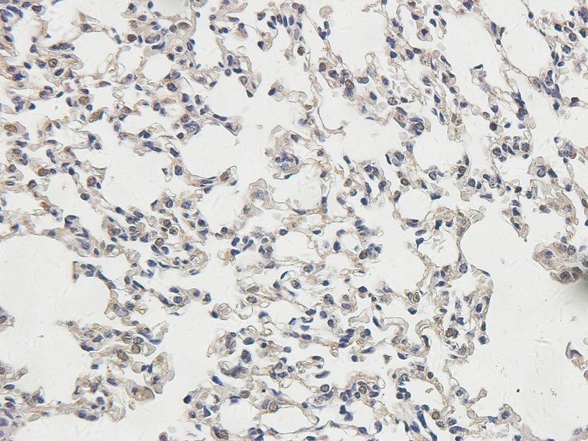 TNFAIP3 Rabbit Polyclonal Antibody