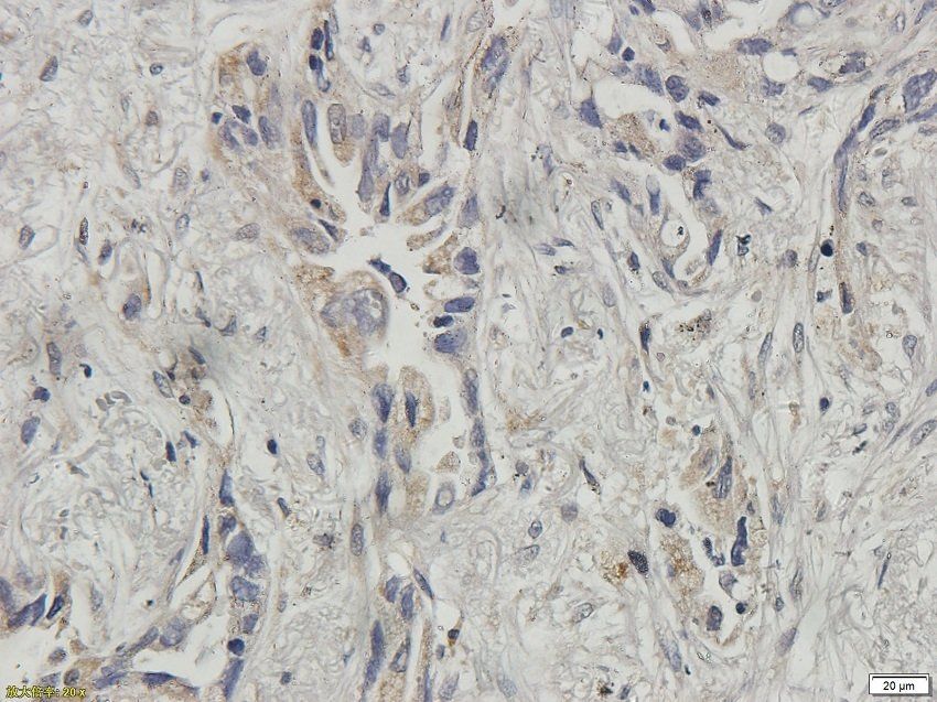 TNFAIP3 Rabbit Polyclonal Antibody