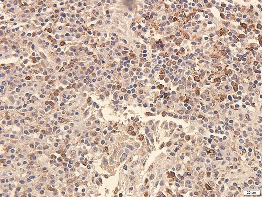 ATRX Rabbit Polyclonal Antibody