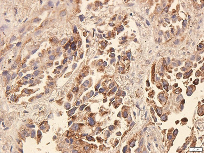 ATRX Rabbit Polyclonal Antibody