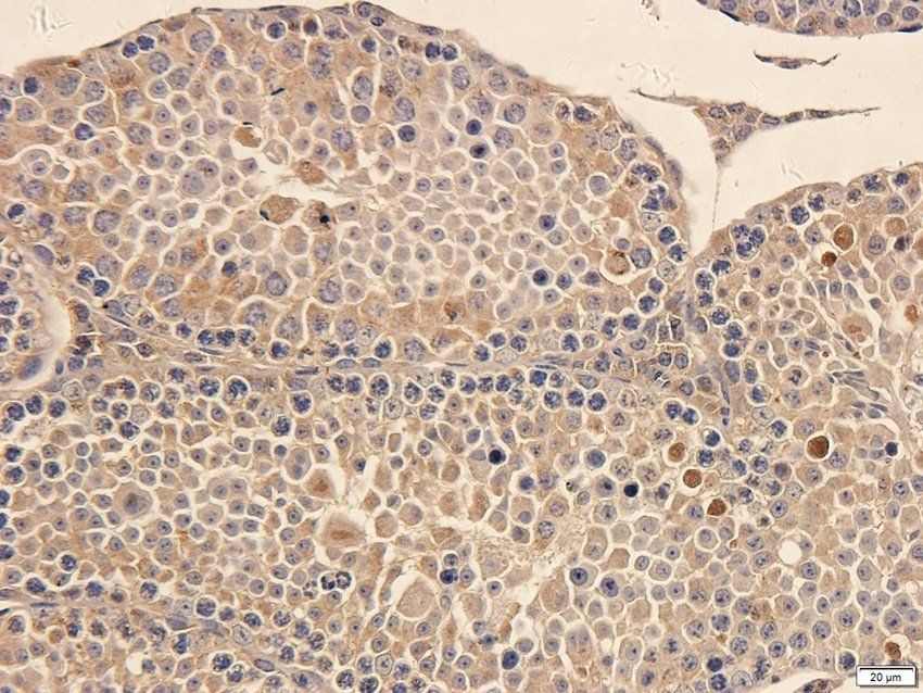 ATRX Rabbit Polyclonal Antibody