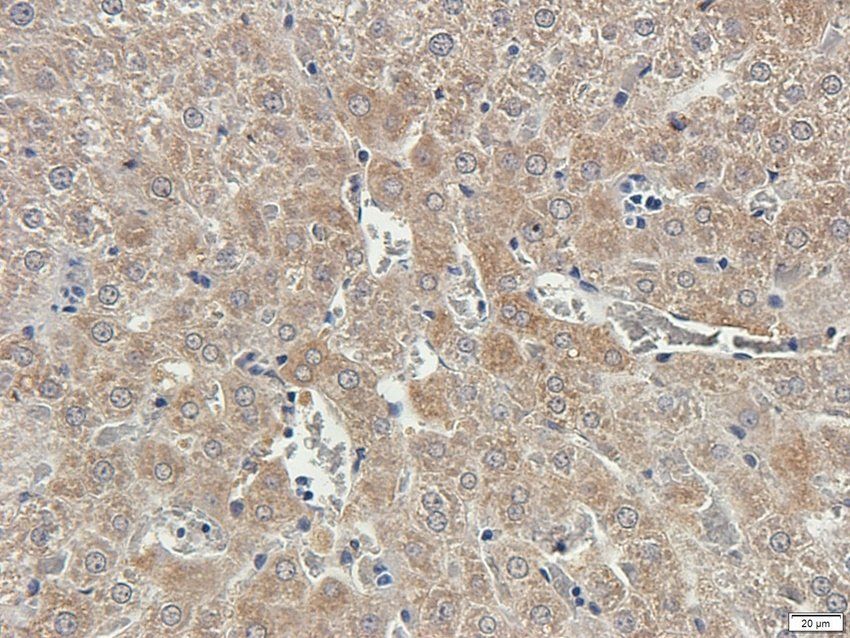 ATRX Rabbit Polyclonal Antibody