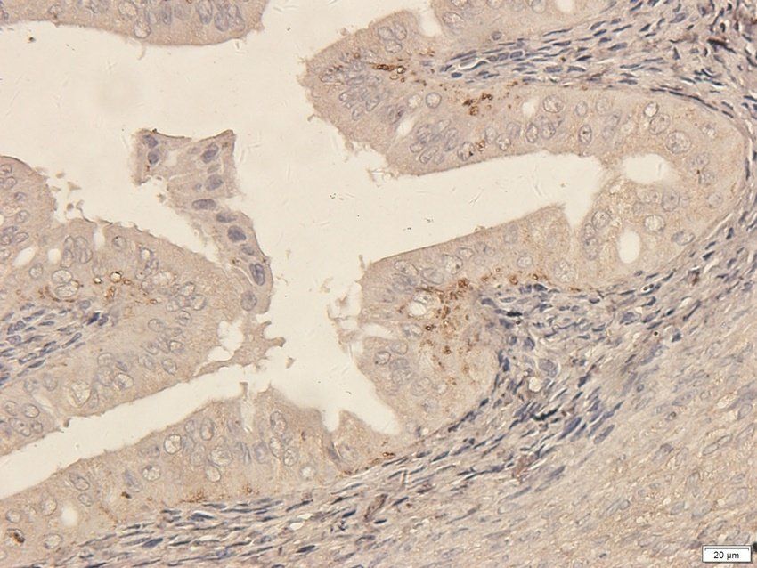 ATRX Rabbit Polyclonal Antibody