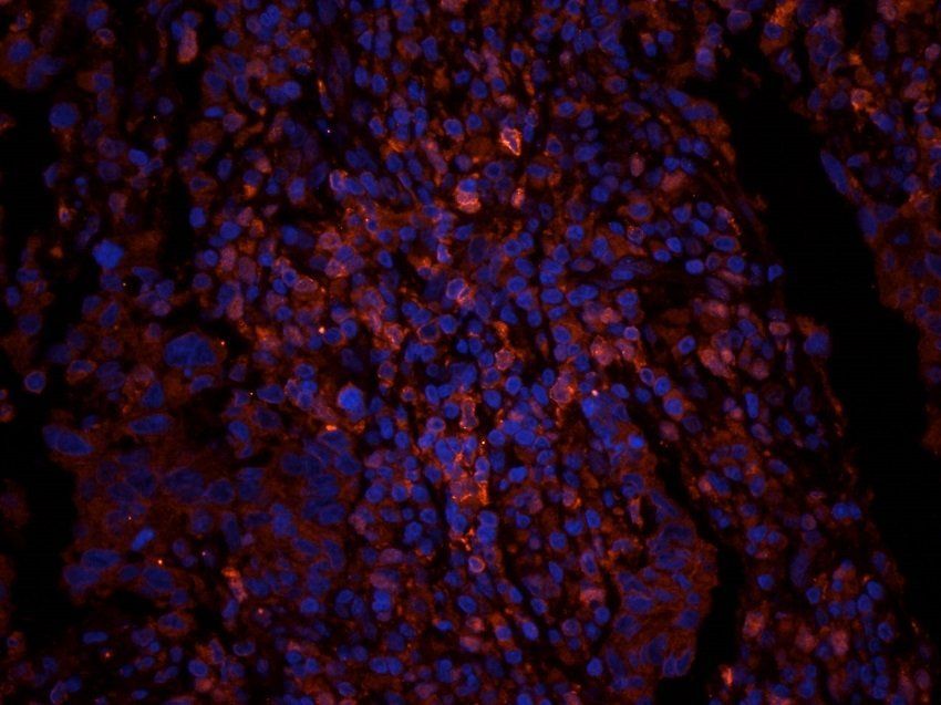 ATRX Rabbit Polyclonal Antibody
