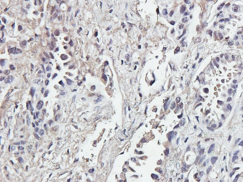 MIF Rabbit Polyclonal Antibody