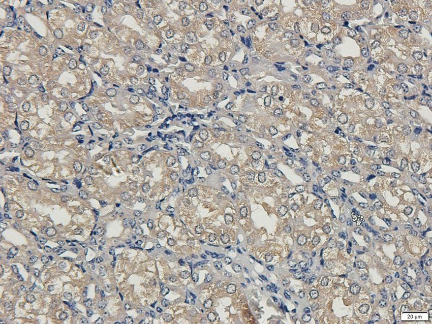 SCG2 Rabbit Polyclonal Antibody