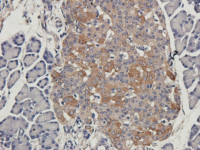 SCG2 Rabbit Polyclonal Antibody